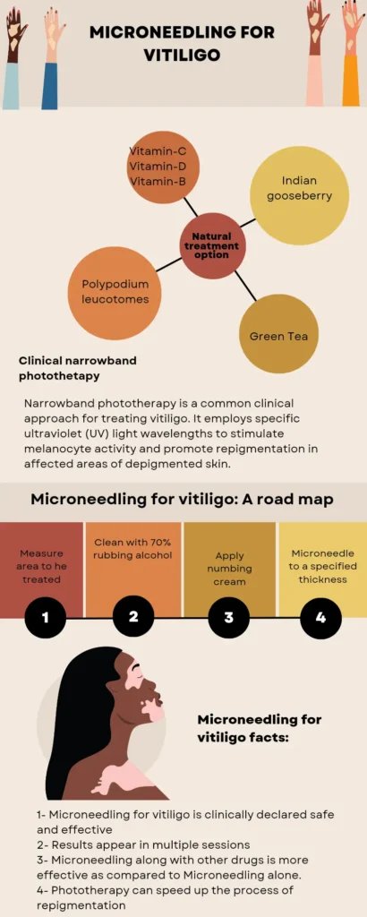 Microneedling for vitiligo, is microneedling safe for vitiligo?.